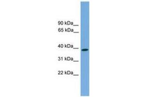 Image no. 1 for anti-Wingless-Type MMTV Integration Site Family, Member 3 (WNT3) (AA 143-192) antibody (ABIN6744872) (WNT3 Antikörper  (AA 143-192))