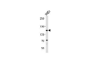 CARD6 Antibody (Center) (ABIN1881136 and ABIN2842626) western blot analysis in WiDr cell line lysates (35 μg/lane). (CARD6 Antikörper  (AA 755-787))