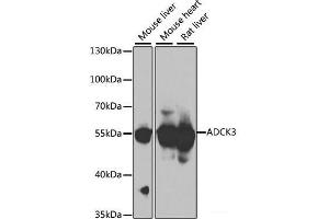 Western blot analysis of extracts of various cell lines using ADCK3 Polyclonal Antibody at dilution of 1:1000. (COQ8A Antikörper)