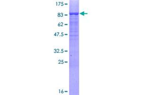 MSL3 Protein (AA 1-521) (GST tag)