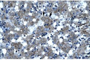 Rabbit Anti-SUPT3H Antibody Catalog Number: ARP30038 Paraffin Embedded Tissue: Human Liver Cellular Data: Hepatocytes Antibody Concentration: 4. (SUPT3H/SPT3 Antikörper  (N-Term))
