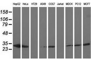 Western blot analysis of extracts (35 µg) from 9 different cell lines by using anti-AK3 monoclonal antibody. (Adenylate Kinase 3 Antikörper)