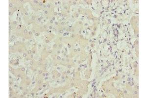 Immunohistochemistry of paraffin-embedded human liver tissue using ABIN7143435 at dilution of 1:100 (ADPGK Antikörper  (AA 218-497))