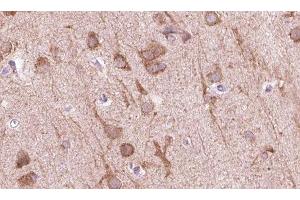 ABIN6273836 at 1/100 staining human brain tissue sections by IHC-P. (5HT1D Antikörper  (Internal Region))