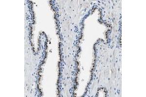 Immunohistochemical staining of human prostate with C16orf79 polyclonal antibody  shows strong cytoplasmic positivity, with a granular pattern, in glandular cells. (BRICD5 Antikörper)