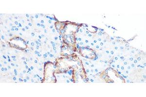 Immunohistochemistry of paraffin-embedded Mouse kidney using YTHDF2 Polyclonal Antibody at dilution of 1:100 (40x lens). (YTHDF2 Antikörper)