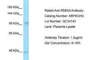 Western Blotting (WB) image for anti-phosphodiesterase 5A, cGMP-Specific (PDE5A) (C-Term) antibody (ABIN2789423) (PDE5A Antikörper  (C-Term))