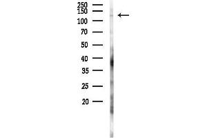 anti-Fibulin 2 (FBLN2) antibody