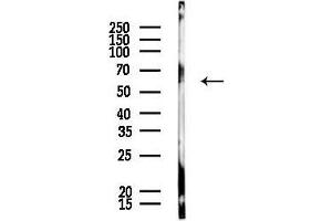 Western blot analysis of lysates from HUVEC cells, using ACRBP Antibody at 1/1000 dilution.