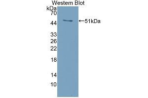 Detection of Recombinant RANkL, Mouse using Polyclonal Antibody to Receptor Activator Of Nuclear Factor Kappa B Ligand (RANkL) (RANKL Antikörper  (AA 92-263))