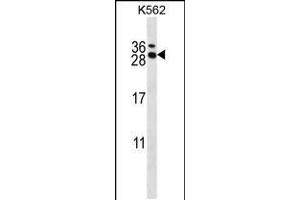 Western blot analysis in K562 cell line lysates (35ug/lane). (RCAN3 Antikörper  (C-Term))