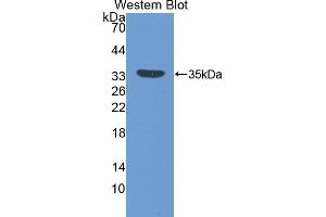 Detection of Recombinant IGFBP5, Mouse using Polyclonal Antibody to Insulin Like Growth Factor Binding Protein 5 (IGFBP5) (IGFBP5 Antikörper  (AA 25-271))