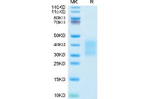Mouse CD79B on Tris-Bis PAGE under reduced condition. (CD79b Protein (AA 26-158) (His tag))