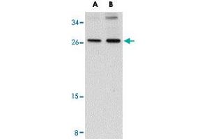 Western blot analysis of SCAMP4 in NIH/3T3 cell lysate with SCAMP4 polyclonal antibody  at (A) 1 and (B) 2 ug/mL . (SCAMP4 Antikörper  (C-Term))