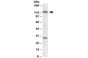 Western blot testing of MOLT4 lysate with UBN1 antibody at 1ug/ml. (Ubinuclein 1 Antikörper)