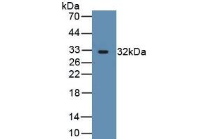 Detection of Recombinant ACTN3, Human using Polyclonal Antibody to Actinin Alpha 3 (ACTN3) (ACTN3 Antikörper  (AA 162-416))