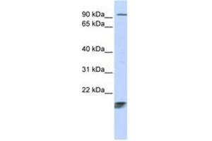 Image no. 1 for anti-Immature Colon Carcinoma Transcript 1 (ICT1) (AA 108-157) antibody (ABIN6743781) (ICT1 Antikörper  (AA 108-157))