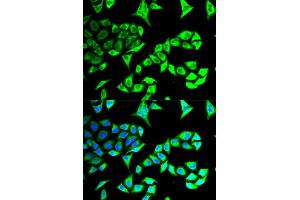 Immunofluorescence analysis of MCF-7 cells using GABARAP antibody (ABIN5973270). (GABARAP Antikörper)