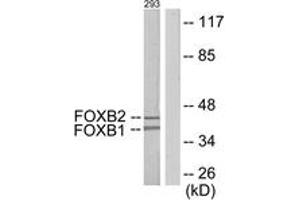 Western blot analysis of extracts from 293 cells, using FOXB1/2 Antibody.