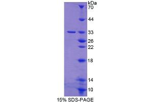 SDS-PAGE (SDS) image for Protein Kinase D3 (PRKD3) (AA 576-832) protein (His tag) (ABIN6238801) (PRKD3 Protein (AA 576-832) (His tag))