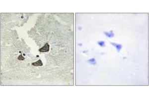 Immunohistochemistry analysis of paraffin-embedded human brain tissue, using EPHB6 Antibody. (EPH Receptor B6 Antikörper  (AA 861-910))