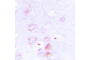 Immunohistochemical analysis of EPB41L2 staining in human brain formalin fixed paraffin embedded tissue section. (EPB41L2 Antikörper  (Center))