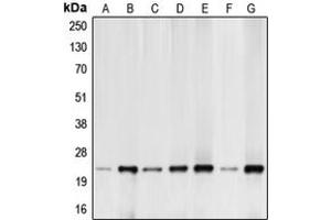 Western blot analysis of BIM expression in HeLa (A), K562 (B), Raji (C), HEK293T (D), MCF7 (E), mouse kidney (F), rat kidney (G) whole cell lysates. (BIM Antikörper  (N-Term))