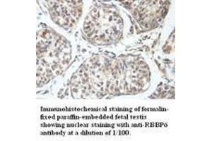 Image no. 1 for anti-Retinoblastoma Binding Protein 6 (RBBP6) antibody (ABIN791194) (RBBP6 Antikörper)