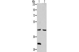Western Blotting (WB) image for anti-Neutral Cholesterol Ester Hydrolase 1 (NCEH1) antibody (ABIN2422362) (NCEH1 Antikörper)