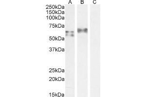 ABIN184812 staining (1 μg/mL) Human Spleen (A) and A549 cell lysate (B) + peptide (C). (IRF5 Antikörper  (C-Term))