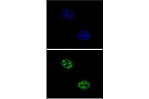 Confocal immunofluorescent analysis of USF1 Antibody (Center) with Hela cell followed by Alexa Fluor 488-conjugated goat anti-rabbit lgG (green). (USF1 Antikörper  (Middle Region))