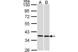 WB Image Sample (30 ug of whole cell lysate) A: 293T B: H1299 10% SDS PAGE antibody diluted at 1:1000 (FAM50A Antikörper)