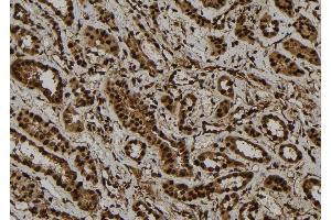 ABIN6277736 at 1/100 staining Human kidney tissue by IHC-P. (GLI1 Antikörper  (C-Term))
