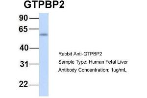 Host:  Rabbit  Target Name:  GTPBP2  Sample Type:  Human Fetal Liver  Antibody Dilution:  1. (GTPBP2 Antikörper  (N-Term))