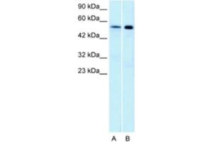 Western Blotting (WB) image for anti-Serotonin Receptor 1A (HTR1A) antibody (ABIN2463750) (Serotonin Receptor 1A Antikörper)
