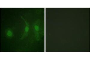 Immunofluorescence analysis of HeLa cells, using IRF3 (Phospho-Ser385) antibody. (IRF3 Antikörper  (pSer385))