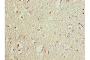Immunohistochemistry of paraffin-embedded human brain tissue using ABIN7165174 at dilution of 1:100 (TNRC5 Antikörper  (AA 31-278))