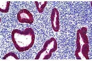 Human Uterus, Endometrium: Formalin-Fixed, Paraffin-Embedded (FFPE) (EpCAM Antikörper)