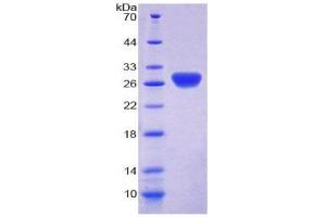 SDS-PAGE (SDS) image for Thioredoxin Reductase 1 (TXNRD1) (AA 208-433) protein (His tag) (ABIN2126947)