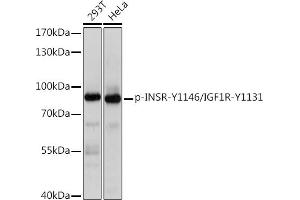 Western Blotting (WB) image for anti-Insulin-Like Growth Factor 1 Receptor (IGF1R) (pTyr1131), (pTyr1146) antibody (ABIN7267901)