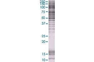ABCC6 transfected lysate.