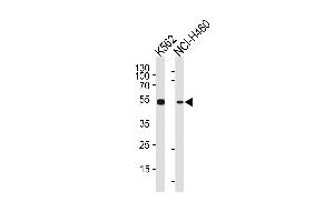 CHEK2 Antibody (N-term) (ABIN1881196 and ABIN2840120) western blot analysis in K562,NCI- cell line lysates (35 μg/lane). (CHEK2 Antikörper  (N-Term))