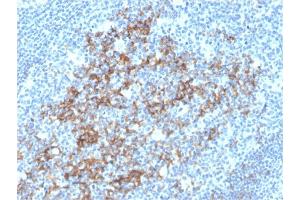 Formalin-fixed, paraffin-embedded human Tonsil stained with CD23-Monospecific Mouse Monoclonal Antibody (FCER2/3592). (FCER2 Antikörper  (AA 48-321))