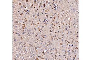 IHC analysis of RPL17 using anti-RPL17 antibody (ABIN7601639). (RPL17 Antikörper  (AA 40-167))