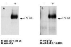 Combined immunoprecipitation and western blot using EGFR antibody. (EGFR Antikörper  (C-Term))