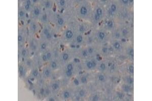Used in DAB staining on fromalin fixed paraffin- embedded Kidney tissue (AGRN Antikörper  (AA 1130-1401))