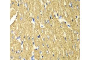 Immunohistochemistry of paraffin-embedded Mouse heart using TPM3 Polyclonal Antibody at dilution of 1:100 (40x lens). (TPM3 Antikörper)