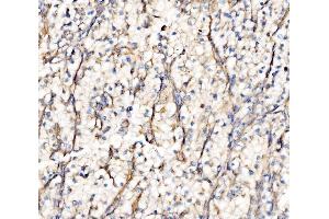 IHC analysis of Integrin Linked ILK using anti-Integrin Linked ILK antibody (ABIN7599411). (ILK Antikörper  (AA 1-452))