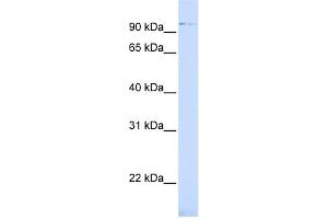 WB Suggested Anti-ZNF598 Antibody Titration:  0. (ZNF598 Antikörper  (Middle Region))