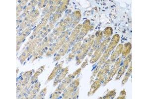 Immunohistochemistry of paraffin-embedded Mouse stomach using NDUFB10 Polyclonal Antibody at dilution of 1:100 (40x lens). (NDUFB10 Antikörper)